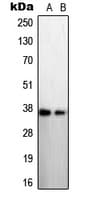 Polyclonal Rabbit anti-Human STEAP1 / STEAP Antibody (N-Terminus, IHC, WB)