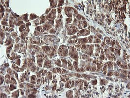 RAB21 Antibody (clone OTI6A9)