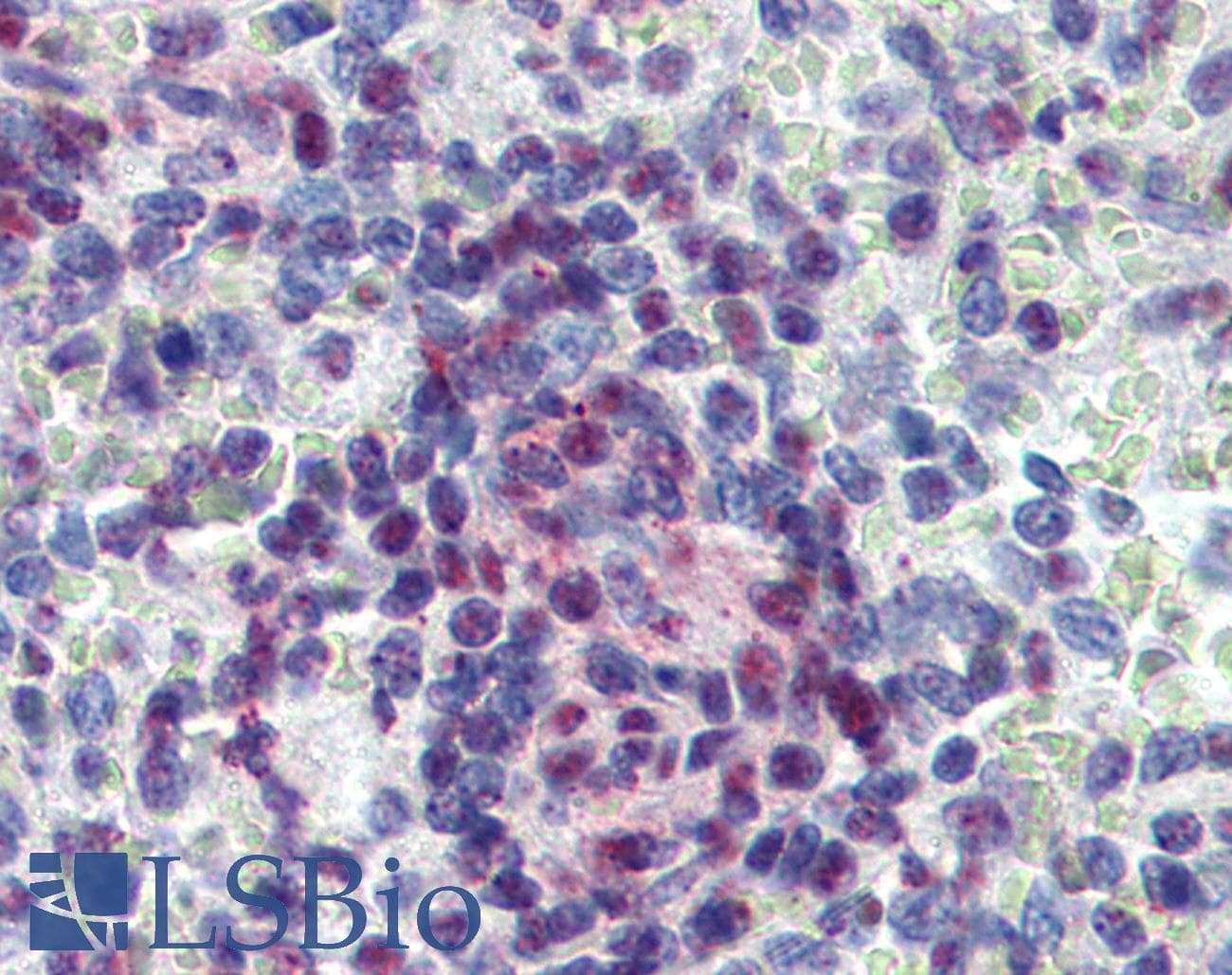 KDM4C / JMJD2C Antibody (C-Terminus)