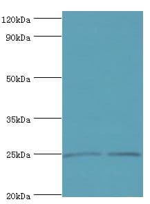 DKK4 Antibody (aa19-224)
