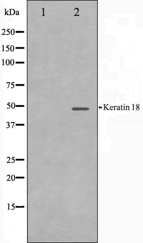KRT18 / CK18 / Cytokeratin 18 Antibody