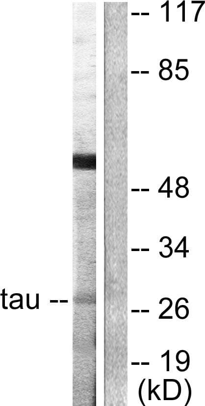 YWHAQ / 14-3-3 Theta Antibody (p232)