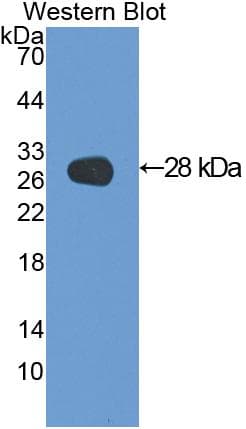 LGALS3 / Galectin 3 Antibody (aa1-262)