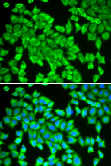 STI1 / STIP1 Antibody