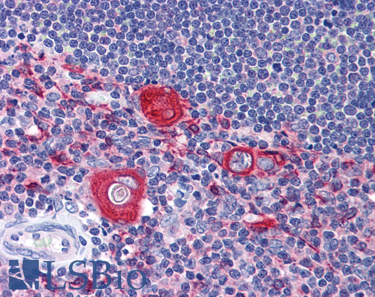 IHC-plus™ SNAPIN Antibody (clone 3H1)