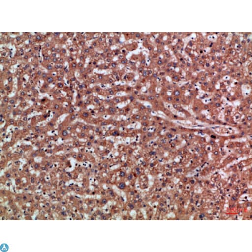 PD-L2 / PDCD1LG2 / CD273 Antibody