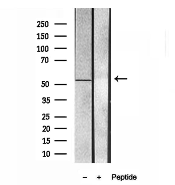 NAG20 / UBAP1 Antibody