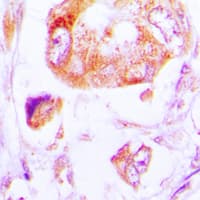 CSNK1A1 / CK1 Alpha Antibody (Internal)