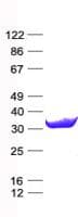 Human SARNP / Hcc-1 / CIP29 Protein (Recombinant His, N-Terminal)