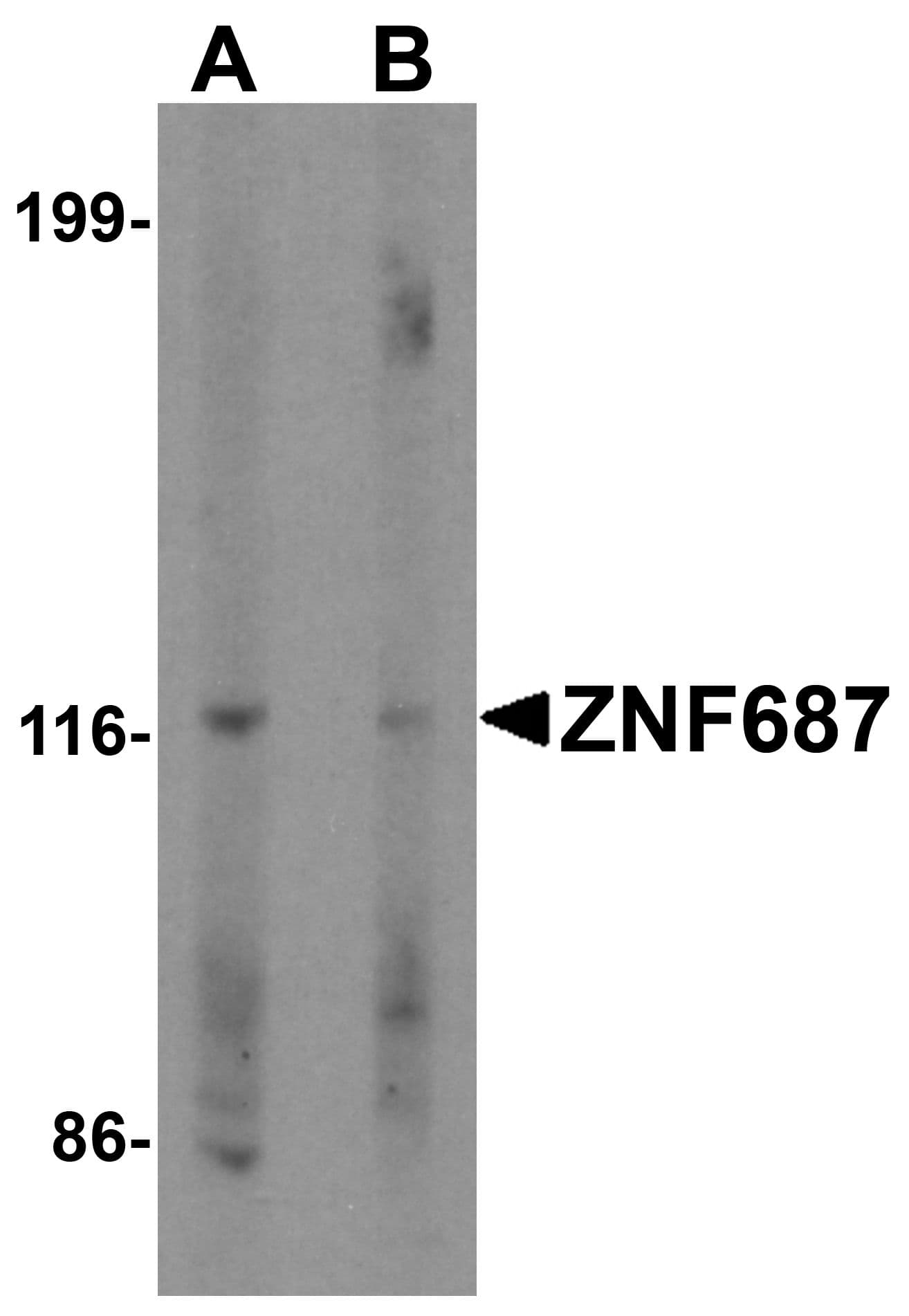 IHC-plus™ Polyclonal Rabbit anti-Human ZNF687 Antibody (IHC, IF, WB)