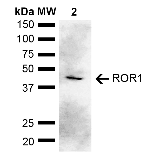 ROR1 Antibody (FITC)