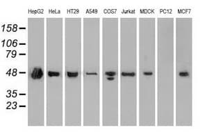 Monoclonal Mouse anti-Human SSB / La Antibody (clone OTI6G7, IHC, IF, WB)