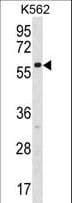 ZNF212 Antibody (aa118-146)