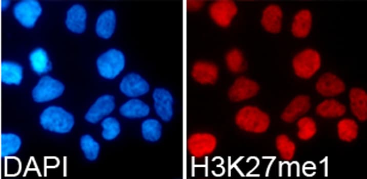 Polyclonal Rabbit anti-Human Histone H3 Antibody (Methyl-Lys27, IHC, IF, WB)