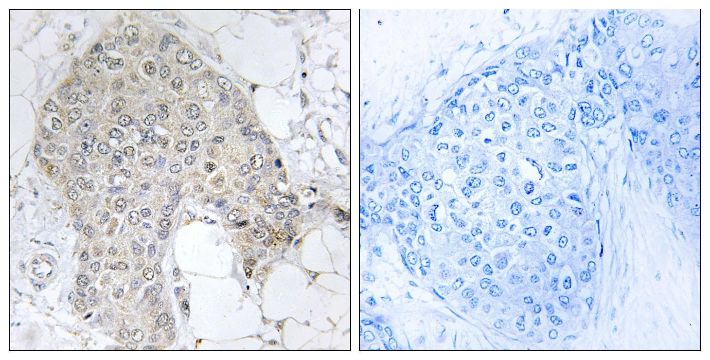 Polyclonal Rabbit anti-Human IPP2 / PPP1R2 Antibody (p120/121, IHC, WB)