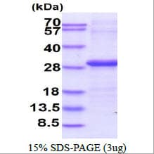 Human FCGR3A / CD16A Protein (Recombinant His)
