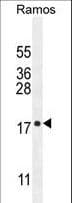 C11orf53 Antibody (aa187-215)
