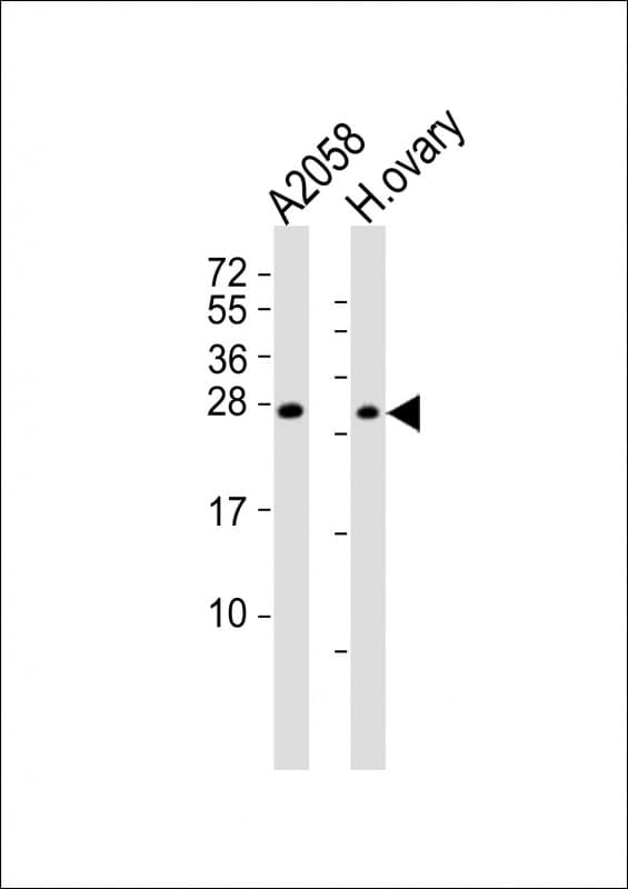 Polyclonal Rabbit anti-Human RHOXF1 Antibody (aa86-120, WB)