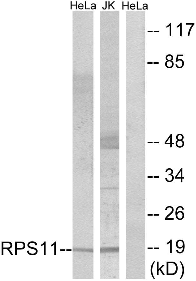RPS11 / Ribosomal Protein 11 Antibody