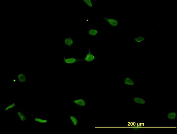 PSMB8 / LMP7 Antibody (clone 1B3)