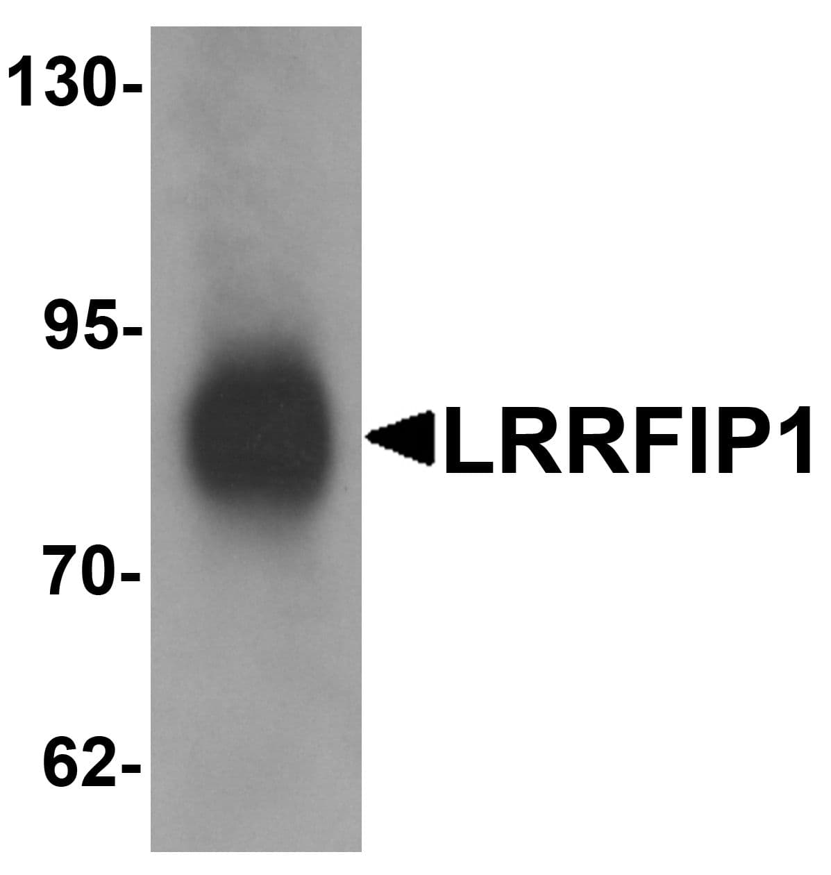 IHC-plus™ Polyclonal Rabbit anti-Human TRIP / LRRFIP1 Antibody (IHC, IF, WB)