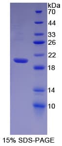 Human HPSE / Heparanase Protein (Recombinant His)