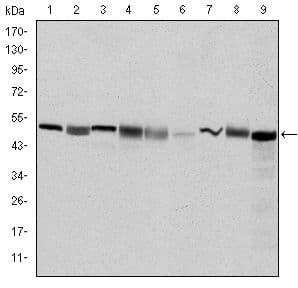 CCT2 / CCT Beta Antibody (clone 5B5F5)