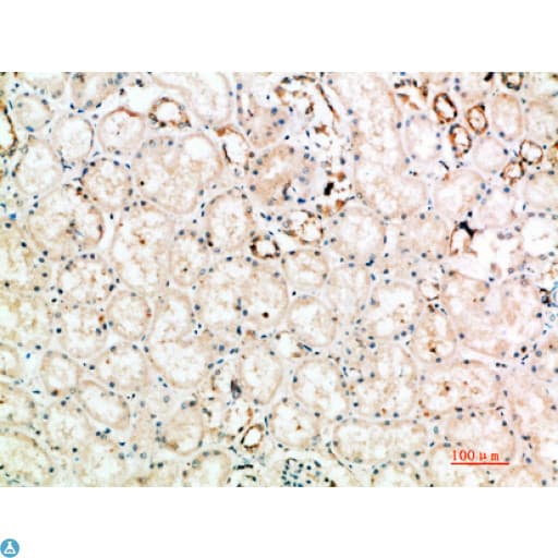 Polyclonal Rabbit anti-Human CTLA4 / CD152 Antibody (IHC)