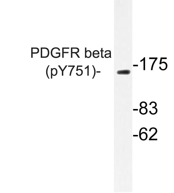 PDGFRB / PDGFR Beta Antibody (phospho-Tyr751)