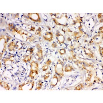 LOXL1 Antibody (aa397-425)