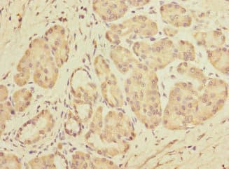 Polyclonal Rabbit anti-Human DET1 Antibody (IHC)