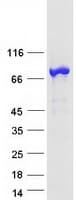Human SETMAR Protein (Recombinant Myc-DDK (Flag))