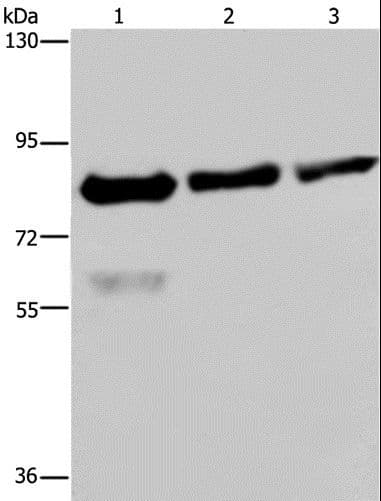 Polyclonal Rabbit anti-Human FASTKD2 Antibody (IHC, WB)