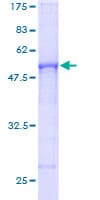 Human RSU1 Protein (Recombinant GST)