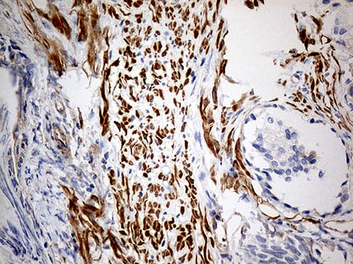 Monoclonal Mouse anti-Human KIF6 Antibody (clone OTI5G2, aa1-350, IHC, WB)