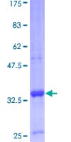 Human GNRH Protein (Recombinant GST)