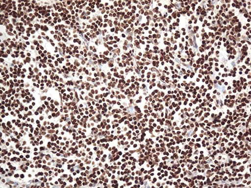 EWSR1 / EWS Antibody (aa256-447, clone OTI2B3)
