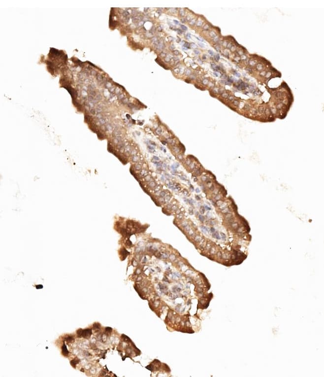 NME2 Antibody (aa137-152)