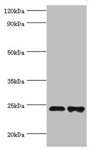 TIRAP Antibody (aa1-221)