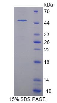 Human PRDM14 Protein (Recombinant His-GST)