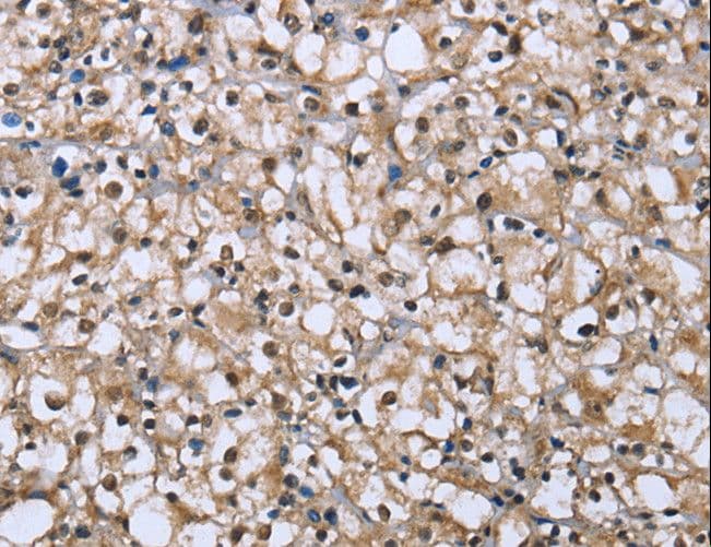 Polyclonal Rabbit anti-Human DYNLL1 / PIN Antibody (IHC, WB)