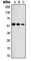 PSMD12 / Rpn5 Antibody (Internal)