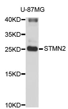 Polyclonal Rabbit anti-Human SCG10 / STMN2 Antibody (IHC, WB)