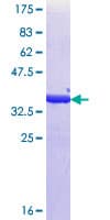 Human ALY / THOC4 Protein (Recombinant GST, N-terminus)