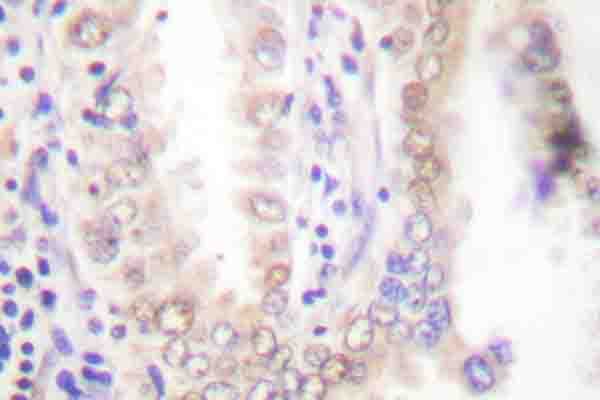 C/EBP Alpha / CEBPA Antibody (phospho-Ser21)