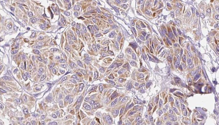 IL-10 Antibody