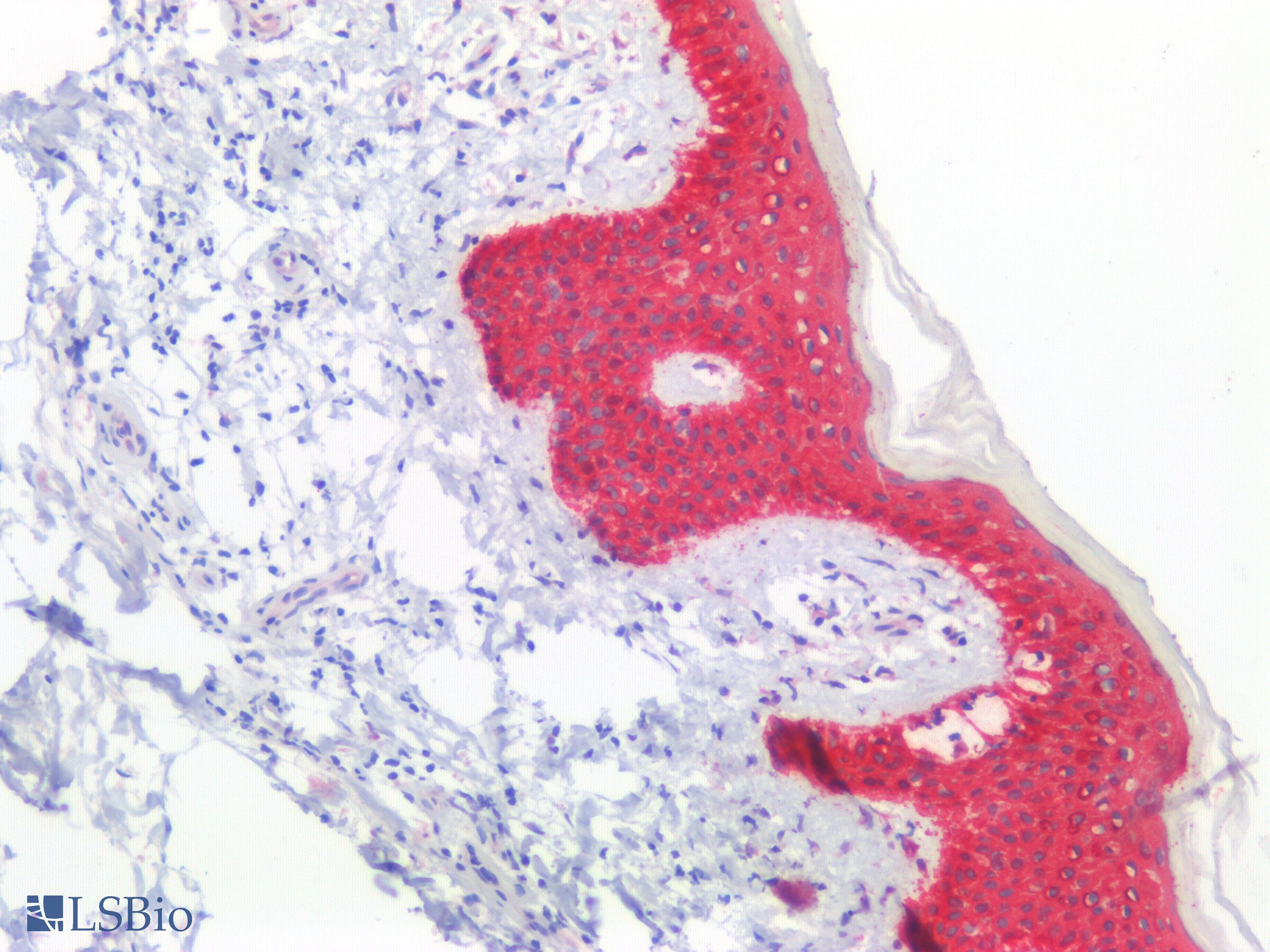 PathPlus™ KRT5 / CK5 / Cytokeratin 5 Antibody (C-Terminus)