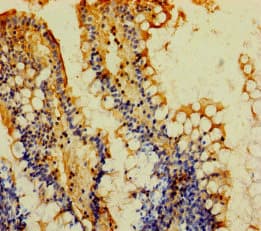 MOGAT2 Antibody