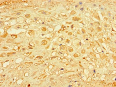 Polyclonal Rabbit anti-Human CHM / REP1 Antibody