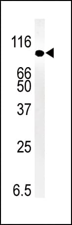 IHC-plus™ SMURF1 Antibody (aa66-96)